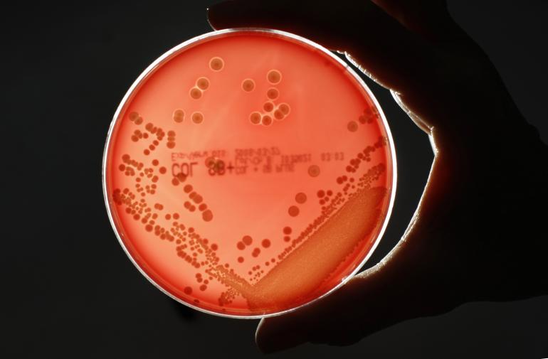 Deadly MRSA Superbug Killed By 1000-Year-Old Anglo-Saxon Remedy