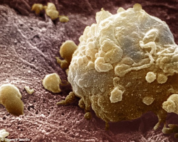 cancercell