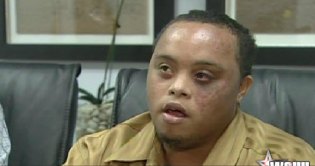 Cops Beat Man with Down Syndrome for Packing Colostomy Bag