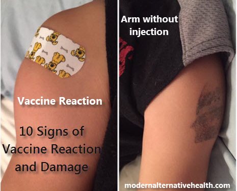 10 signs of a vaccine reaction.