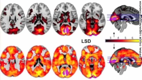 Clinical Trial Suggests Psychedelic Drugs Could Be Used To Treat Depression and Addiction