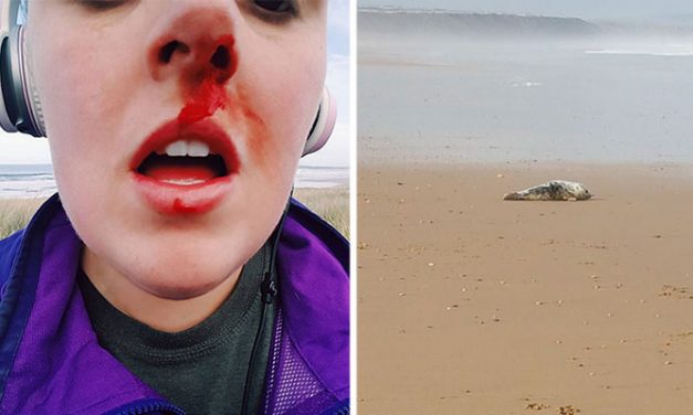 Activist Gets Punched In The Face After Confronting Teens Who Were Torturing A Seal