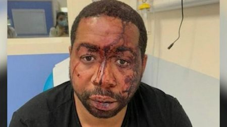 France’s Macron “Very Shocked” Over Filmed Police Beating of Black Man for Not Wearing Mask