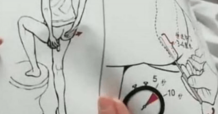 Chinese Expert: Anal Swabs Are Best Way to Detect COVID-19, Reduce False Positives