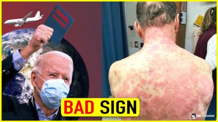 WHOA! These Side Effects Are CRAZY!