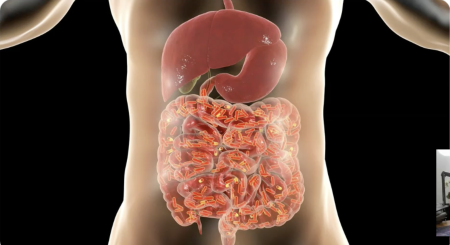 FREE VIDEO: HEAL Your Gut RIGHT NOW!
